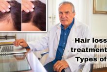 Hair Loss Treatment (2025)