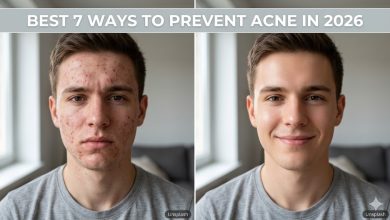 Best 7 Ways to Prevent Acne in 2026